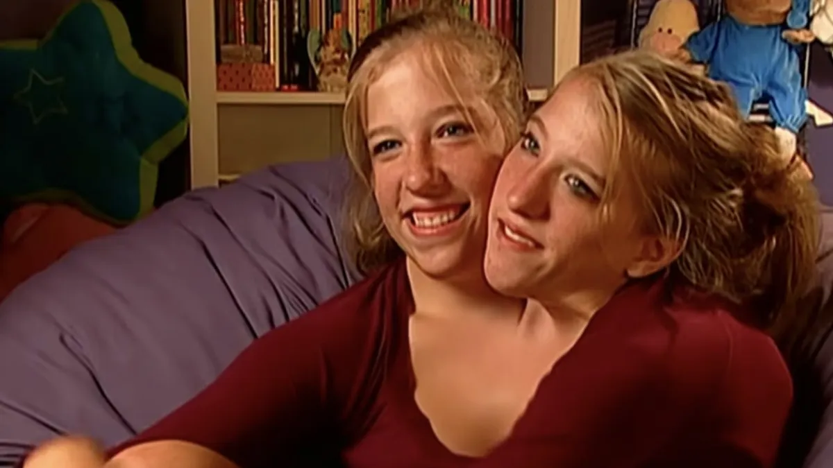 Conjoined Twin Abby Hensel Is Now Married!