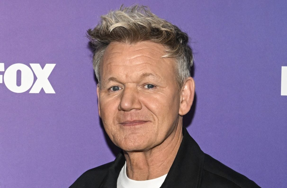 Gordon Ramsay Shows EXTREME Bruise From Bicycle Accident